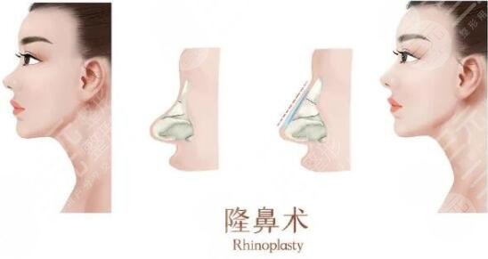  Introduction to the list of plastic surgeons in Shanghai 455 Hospital