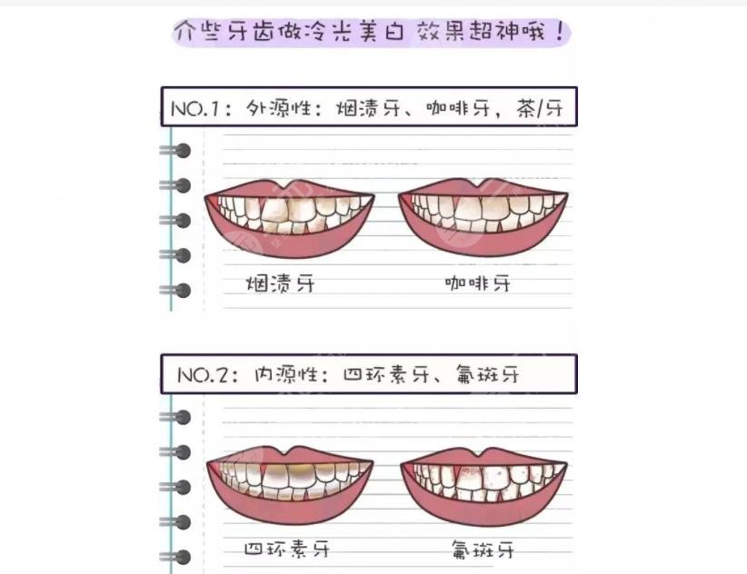 广州柏德口腔怎么样