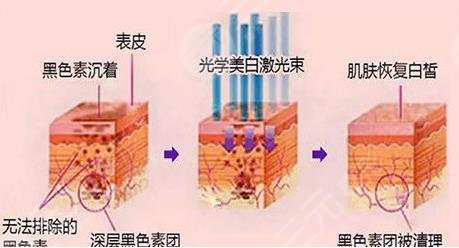 龍華人民醫(yī)院點陣激光掛什么科