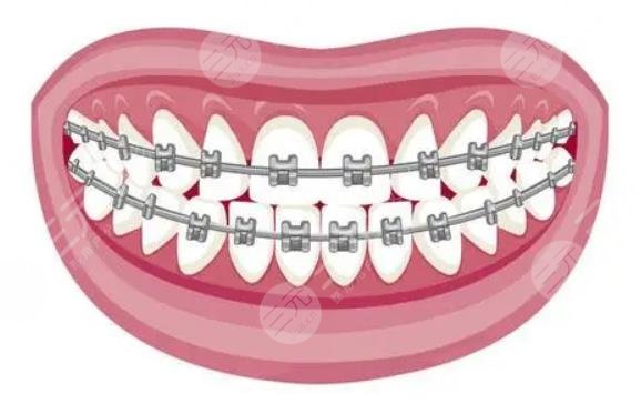 广州柏德口腔医院牙齿矫正好吗