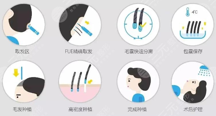 广州仁健植发怎么样