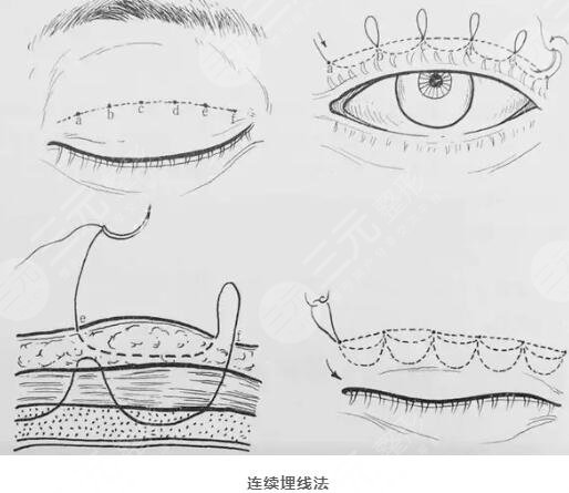  Anshan Qimin Beauty Hospital How about double eyelids