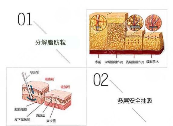 清远人民医院整形美容科项目介绍