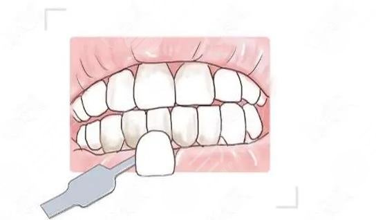  How much is dental correction in Maoming People's Hospital