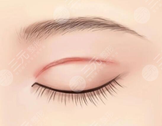  Zibo Central Hospital How about double eyelid surgery