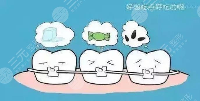 中山人民医院牙齿种植多少钱