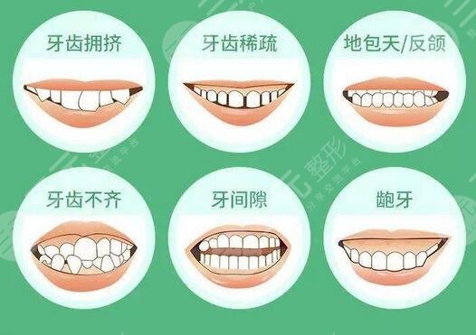 惠州人民医院做牙齿矫正怎么样