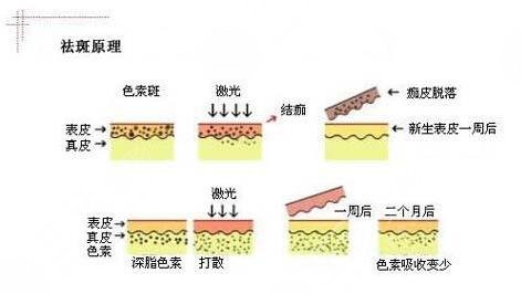 北大國(guó)際醫(yī)院美容祛斑怎么樣