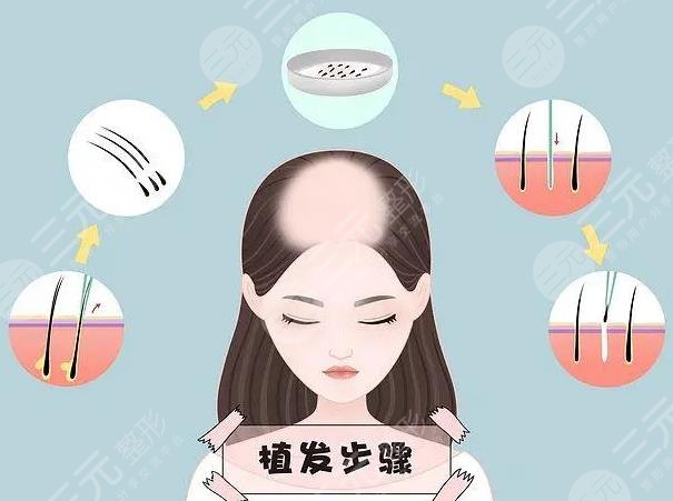  How about the Hair Transplantation Department of Shanghai Ninth People's Hospital