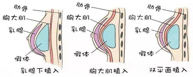 海淀醫(yī)院整形科怎么樣