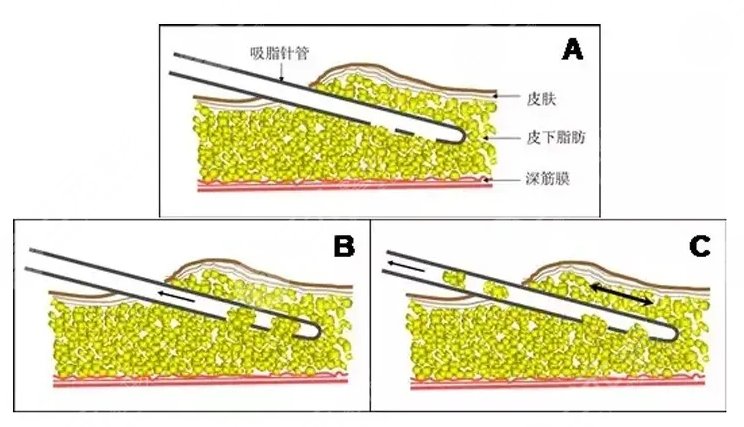 北京大学第三医院美容好吗