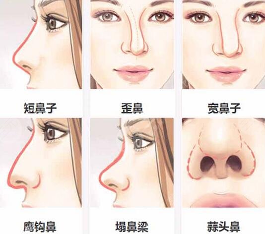  How about the plastic surgery department of the Second Affiliated Hospital of Guangzhou Medical University