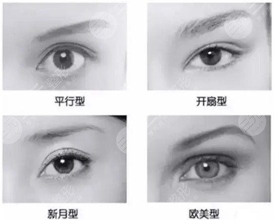  How about the double eyelid surgery in Longgang Central Hospital