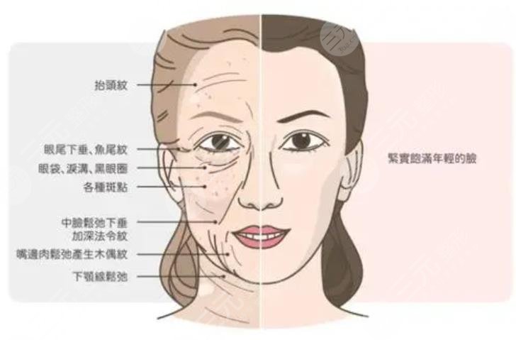  What are Tianjin Peeling and Wrinkle Removal Hospital