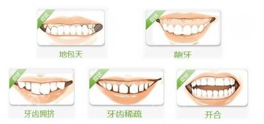  How about orthodontics in Dongguan People's Hospital