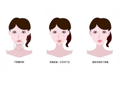  The ranking of Shanghai orthognathic surgery hospitals has been updated