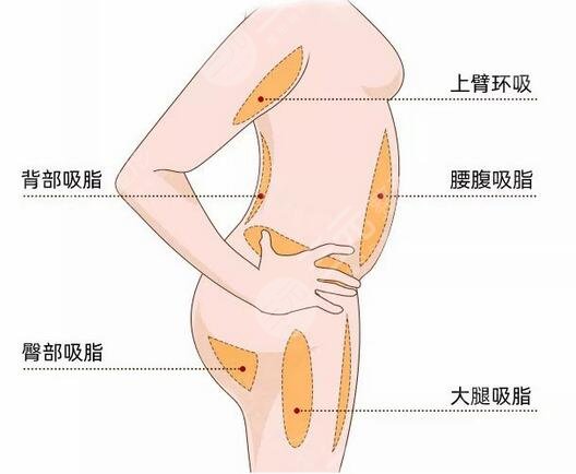  How about liposuction in Tianjin First Central Hospital