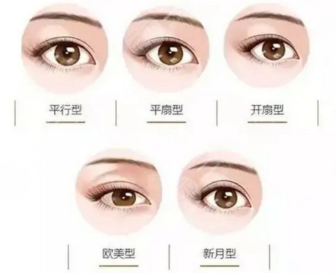  Can Jiangmen Central Hospital have double eyelids cut