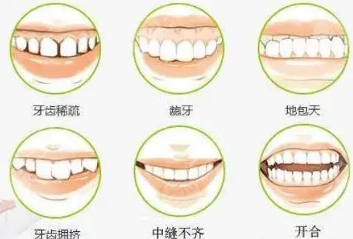  How about orthodontics in Taizhou Central Hospital