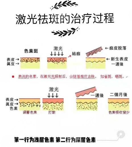 湖南省人民医院祛斑怎么样