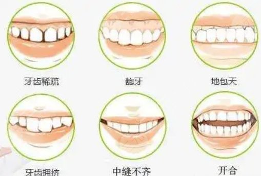 北京大学深圳医院口腔科牙齿矫正价格高吗