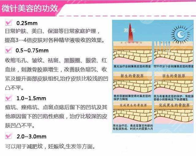 上海九院黄金微针价格表更新