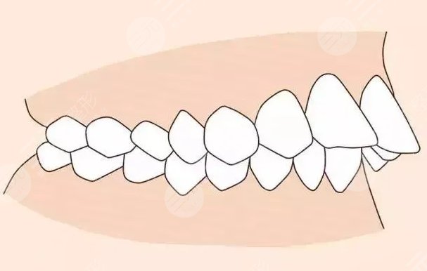  How about orthodontics in Wuxi Second People's Hospital