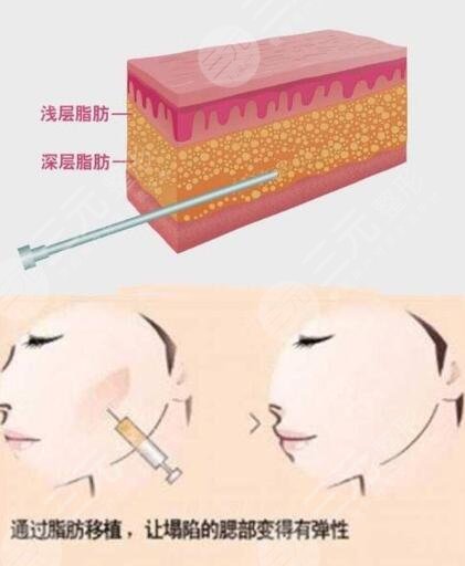  How about the plastic surgery department of the General Hospital of Chengdu Military Region