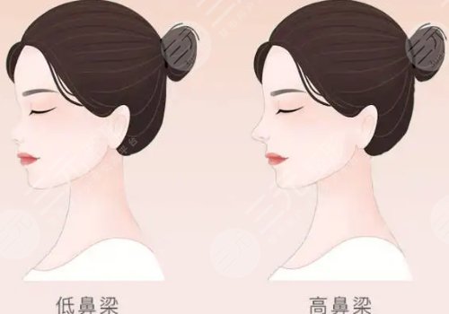  How is Beijing Huangsi Plastic Surgery Hospital