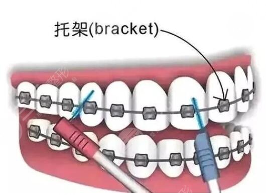 美奧口腔醫(yī)院是正規(guī)醫(yī)院?jiǎn)?/></p>            </div>
            <section style=