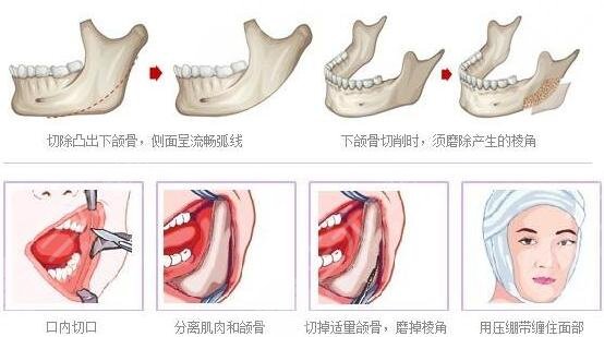 鄭大二附院的醫(yī)療美容科怎么樣