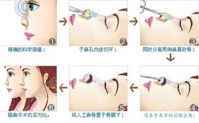  How about the beauty department of Shijiazhuang Second Hospital