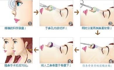 惠州中心人民医院整形外科的技术怎么样呢