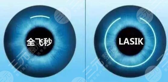 广州做近视手术哪家比较好