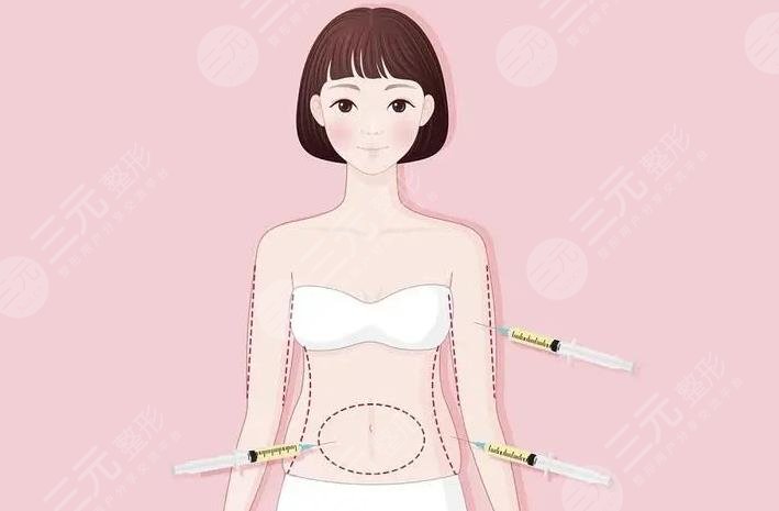  Does Shenzhen People's Hospital have liposuction