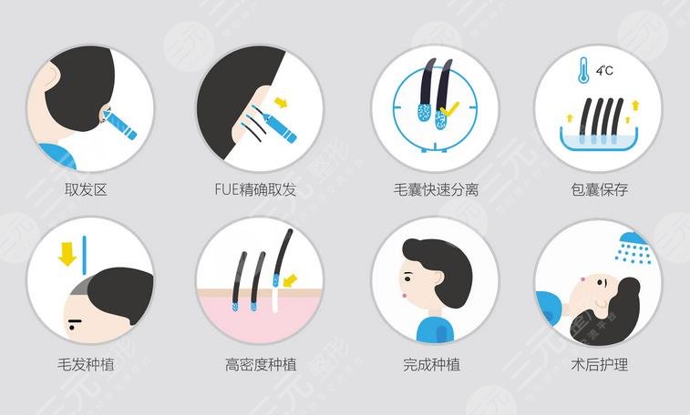  How about hair transplant in Guangdong Traditional Chinese Medicine Hospital