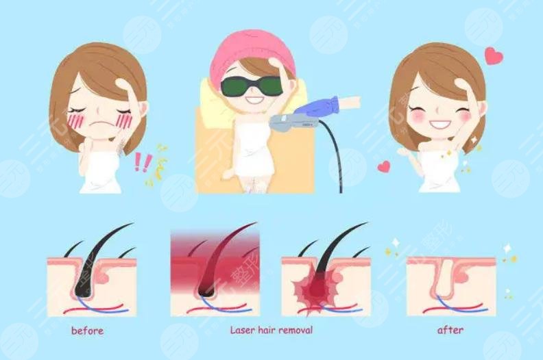  Maoming People's Hospital Laser Hair Removal