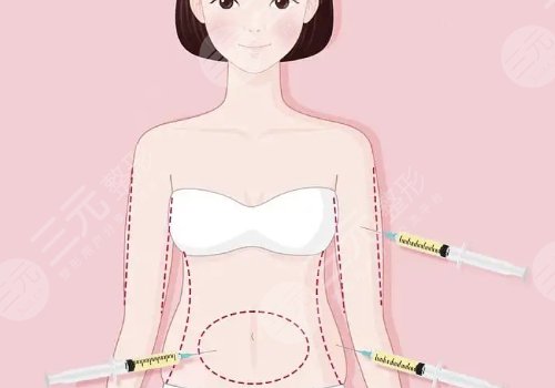  How about plastic surgery in Xi'an Huaren Hospital