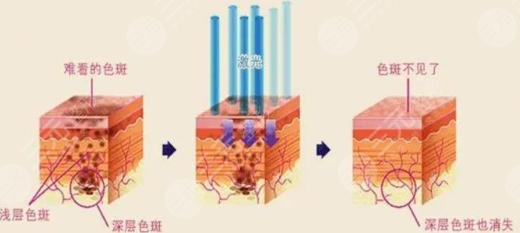 廣東省皮膚病醫(yī)院激光美容中心怎么樣