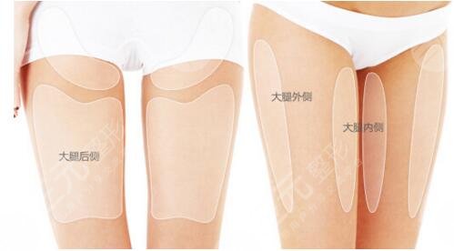  Is liposuction technique reliable in Zhongshan Third Hospital