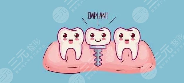  Is dental implant expensive in Zhongshan People's Hospital