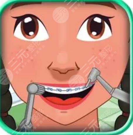 哈尔滨医大一院牙齿矫正效果如何