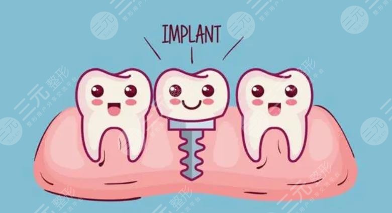  How much is dental implant in Zhongshan Third Hospital