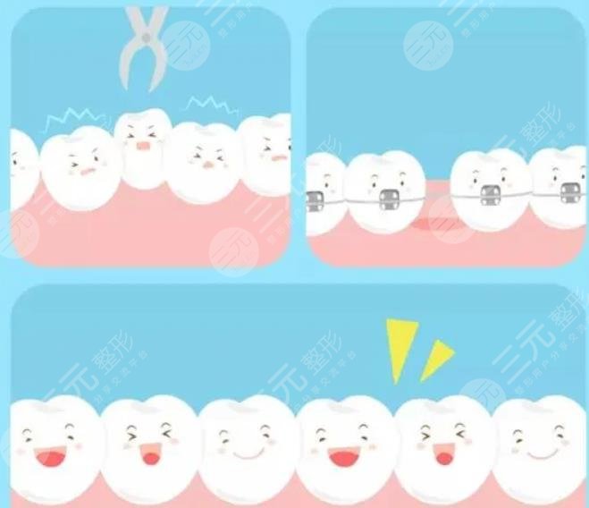  How about orthodontics in Jiaozuo Second People's Hospital