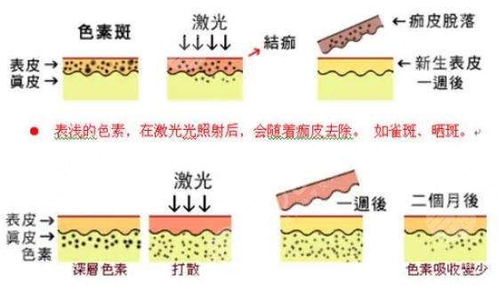 上海第九人民醫(yī)院祛斑價格大概多少