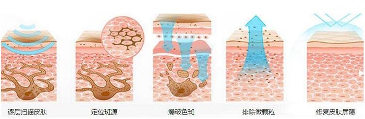 廣東省皮膚病醫(yī)院激光祛斑多少錢