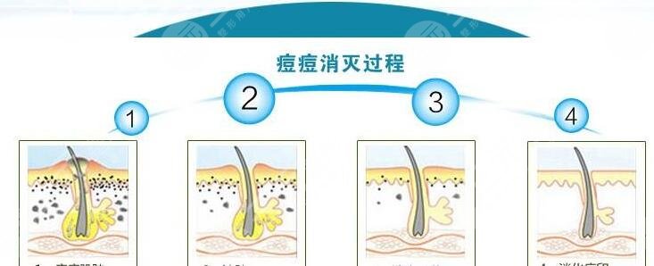 汕头附二美容科激光怎么样