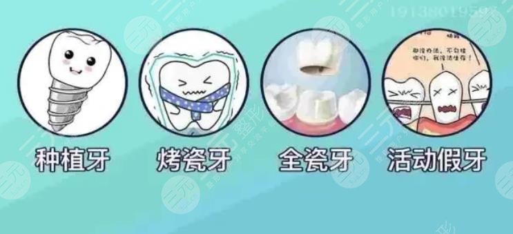 广州中医药大学第一附属医院种植牙价格出来了
