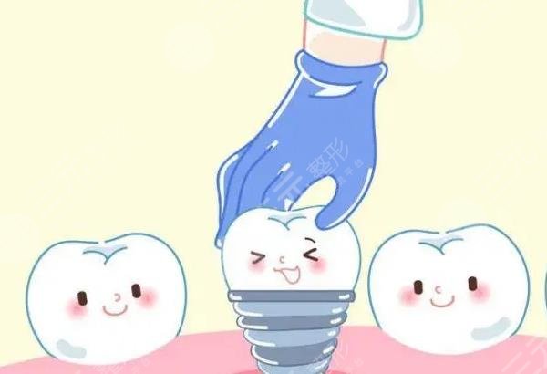  The price of dental implants in Chengdu Second People's Hospital was exposed