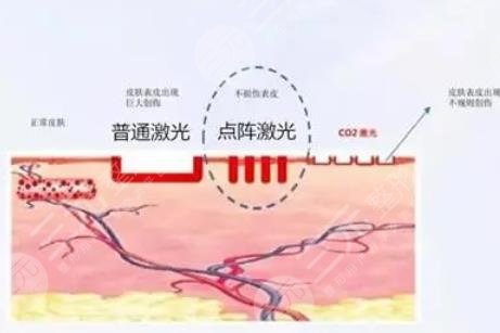 广州曙光整形医院做激光设备怎么样